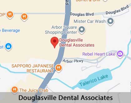 Map image for Dental Implants in Douglasville, GA