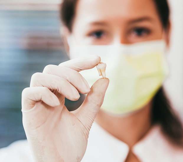 Douglasville Tooth Extraction